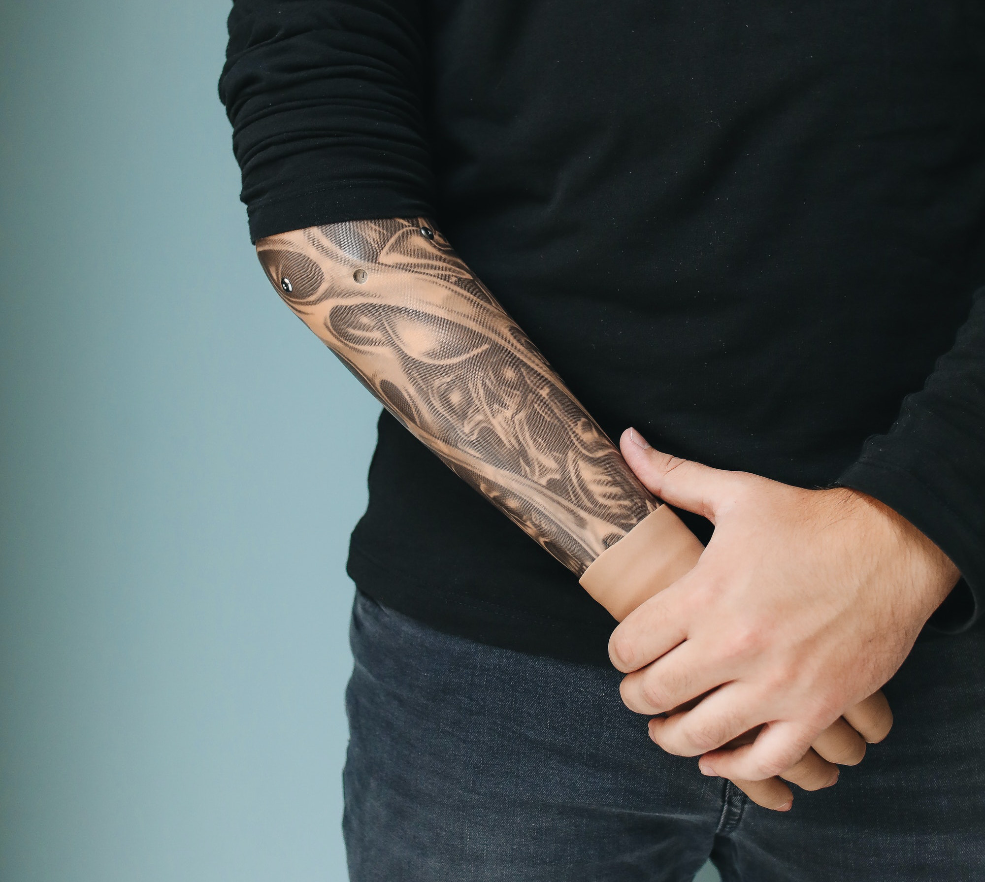 Person med armprotese